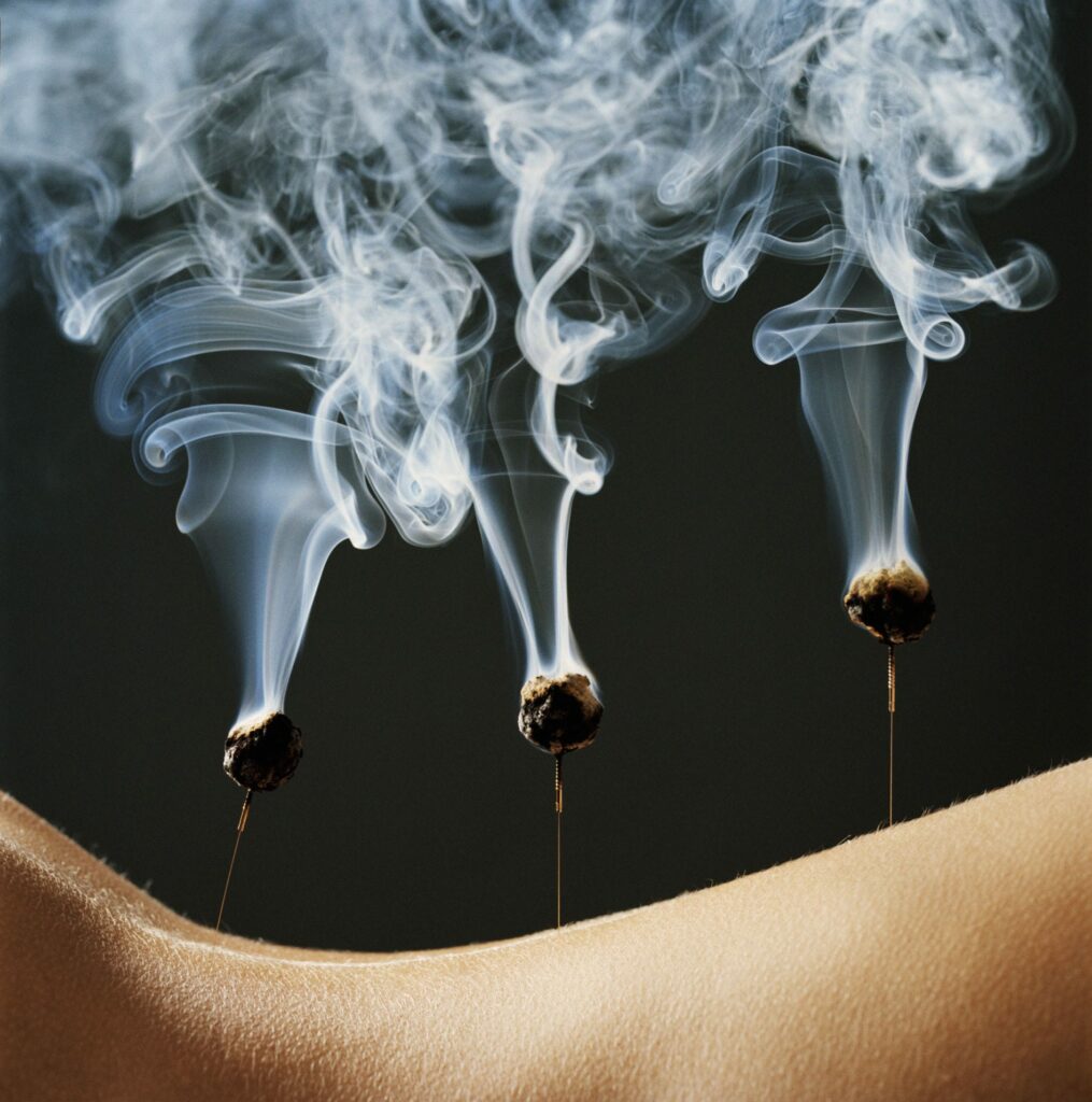 Moxibustion Chinese Therapy 